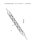 VASCULAR AND BODILY DUCT TREATMENT DEVICES AND METHODS diagram and image