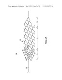 VASCULAR AND BODILY DUCT TREATMENT DEVICES AND METHODS diagram and image