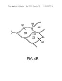 VASCULAR AND BODILY DUCT TREATMENT DEVICES AND METHODS diagram and image