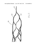 VASCULAR AND BODILY DUCT TREATMENT DEVICES AND METHODS diagram and image