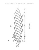 VASCULAR AND BODILY DUCT TREATMENT DEVICES AND METHODS diagram and image