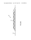 VASCULAR AND BODILY DUCT TREATMENT DEVICES AND METHODS diagram and image