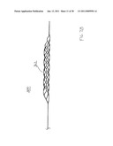 VASCULAR AND BODILY DUCT TREATMENT DEVICES AND METHODS diagram and image