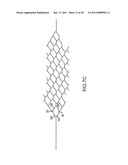 VASCULAR AND BODILY DUCT TREATMENT DEVICES AND METHODS diagram and image