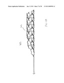 VASCULAR AND BODILY DUCT TREATMENT DEVICES AND METHODS diagram and image