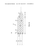 VASCULAR AND BODILY DUCT TREATMENT DEVICES AND METHODS diagram and image