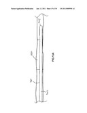 VASCULAR AND BODILY DUCT TREATMENT DEVICES AND METHODS diagram and image