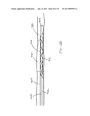 VASCULAR AND BODILY DUCT TREATMENT DEVICES AND METHODS diagram and image