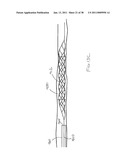 VASCULAR AND BODILY DUCT TREATMENT DEVICES AND METHODS diagram and image