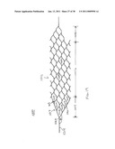 VASCULAR AND BODILY DUCT TREATMENT DEVICES AND METHODS diagram and image