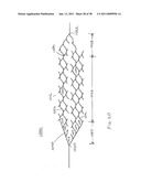 VASCULAR AND BODILY DUCT TREATMENT DEVICES AND METHODS diagram and image