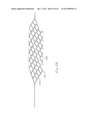 VASCULAR AND BODILY DUCT TREATMENT DEVICES AND METHODS diagram and image