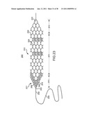 VASCULAR AND BODILY DUCT TREATMENT DEVICES AND METHODS diagram and image