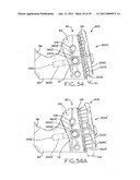 METHODS AND APPARATUSES FOR ATTACHING TISSUE TO ORTHOPAEDIC IMPLANTS diagram and image