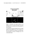 PRODUCTS AND THEIR USE FOR THE DIAGNOSIS, PREVENTION AND/OR CARE OF HUMAN AND/OR ANIMAL PATHOLOGIES CHARACTERISED BY THE ANOMALOUS DEPOSITION OF B-AMYLOID AND/OR AMYLOID-LIKE SUBSTANCE IN HUMAN AND/OR ANIMAL ORGANS AND TISSUES, AND SCREENING METHOD FOR DETERMINING THE RISK OF SUCH PATHOLOGIES diagram and image