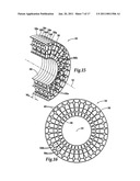 TENSION-BASED NON-PNEUMATIC TIRE diagram and image