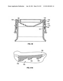 DESIGN AND MANUFACTURE OF REMOVABLE MEMBRANE SEALING COMPONENTS FOR CONSUMER PACKAGING diagram and image