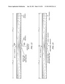 Simplified Silicon Drift Detector and Wraparound Neutron Detector diagram and image