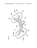 AIR-BAG DEVICE, AND VEHICLE OCCUPANT S LOWER LIMB PROTECTING DEVICE AND DEVICE FOR PROTECTING OCCUPANT AT THE TIME OF VEHICLE SIDE COLLISION USING THE SAME diagram and image