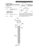 MASONRY ANCHOR diagram and image