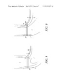 TURBINE WITH AXIAL DISCONTINUITY diagram and image