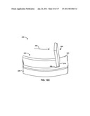 Substrate Features for Mitigating Stress diagram and image