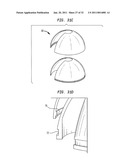 LASER-PRODUCED POROUS STRUCTURE diagram and image