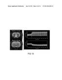 Drug Delivery Nanodevice, its Preparation Method and Uses Thereof diagram and image