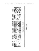 Compositions and Methods For Inducing Apoptosis In Tumor Cells diagram and image