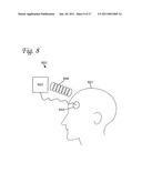 BRAIN STIMULATION SYSTEMS AND METHODS diagram and image