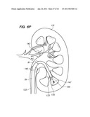 ENDOSCOPIC ROBOTIC CATHETER SYSTEM diagram and image