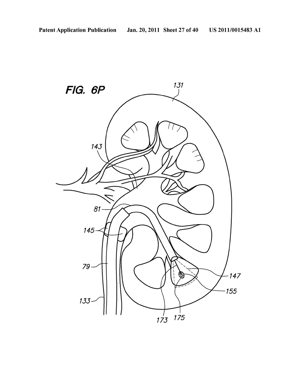 ENDOSCOPIC ROBOTIC CATHETER SYSTEM - diagram, schematic, and image 28