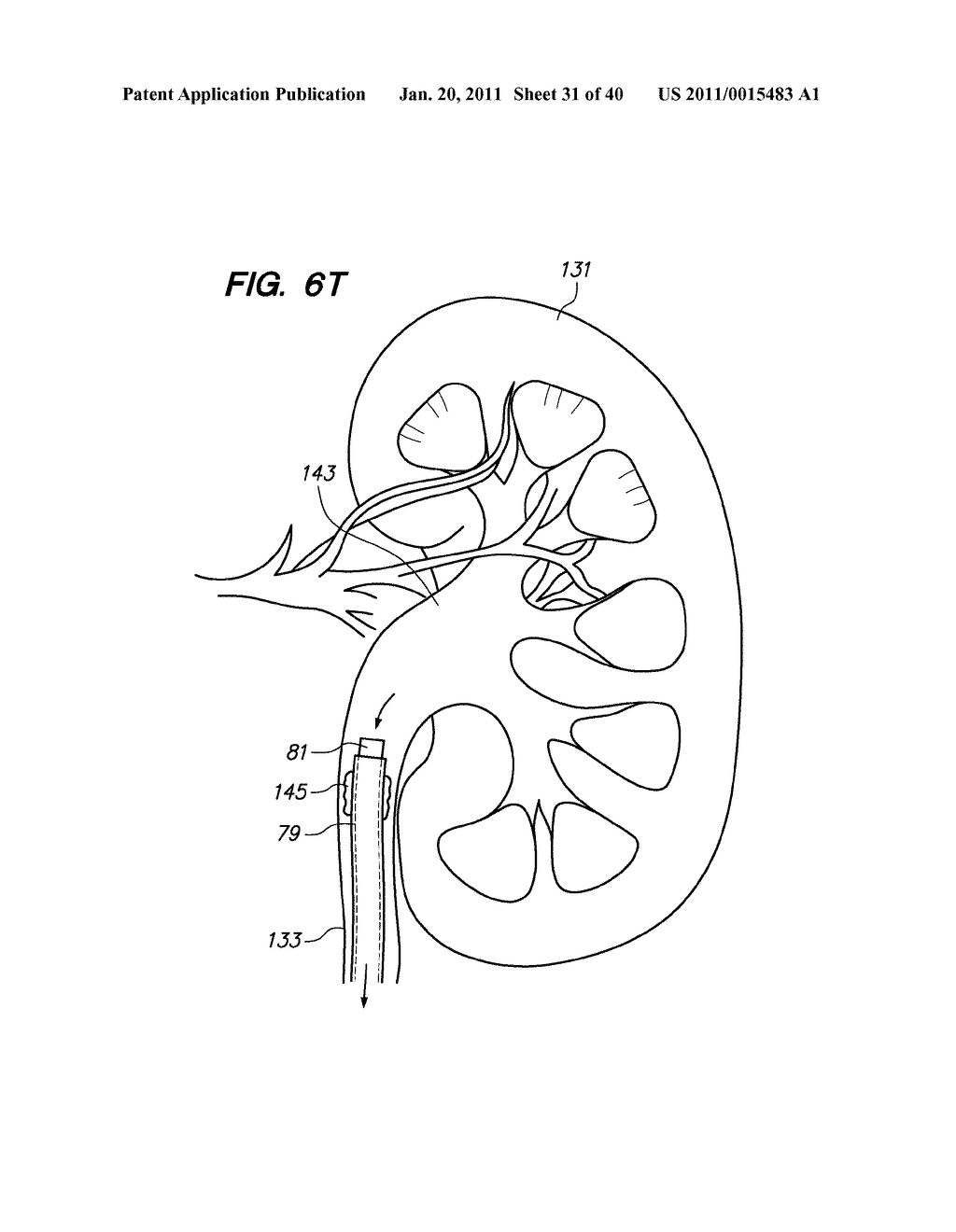 ENDOSCOPIC ROBOTIC CATHETER SYSTEM - diagram, schematic, and image 32