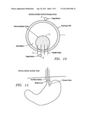 METHODS AND APPARATUS FOR TREATMENT OF OBESITY diagram and image