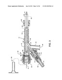 Direct Stream Hydrodynamic Catheter System diagram and image