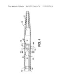 Direct Stream Hydrodynamic Catheter System diagram and image