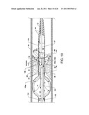 Direct Stream Hydrodynamic Catheter System diagram and image