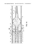 Direct Stream Hydrodynamic Catheter System diagram and image