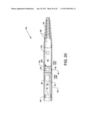 Direct Stream Hydrodynamic Catheter System diagram and image