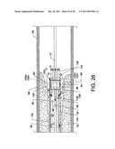 Direct Stream Hydrodynamic Catheter System diagram and image