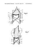 TENSIONING SYSTEM diagram and image