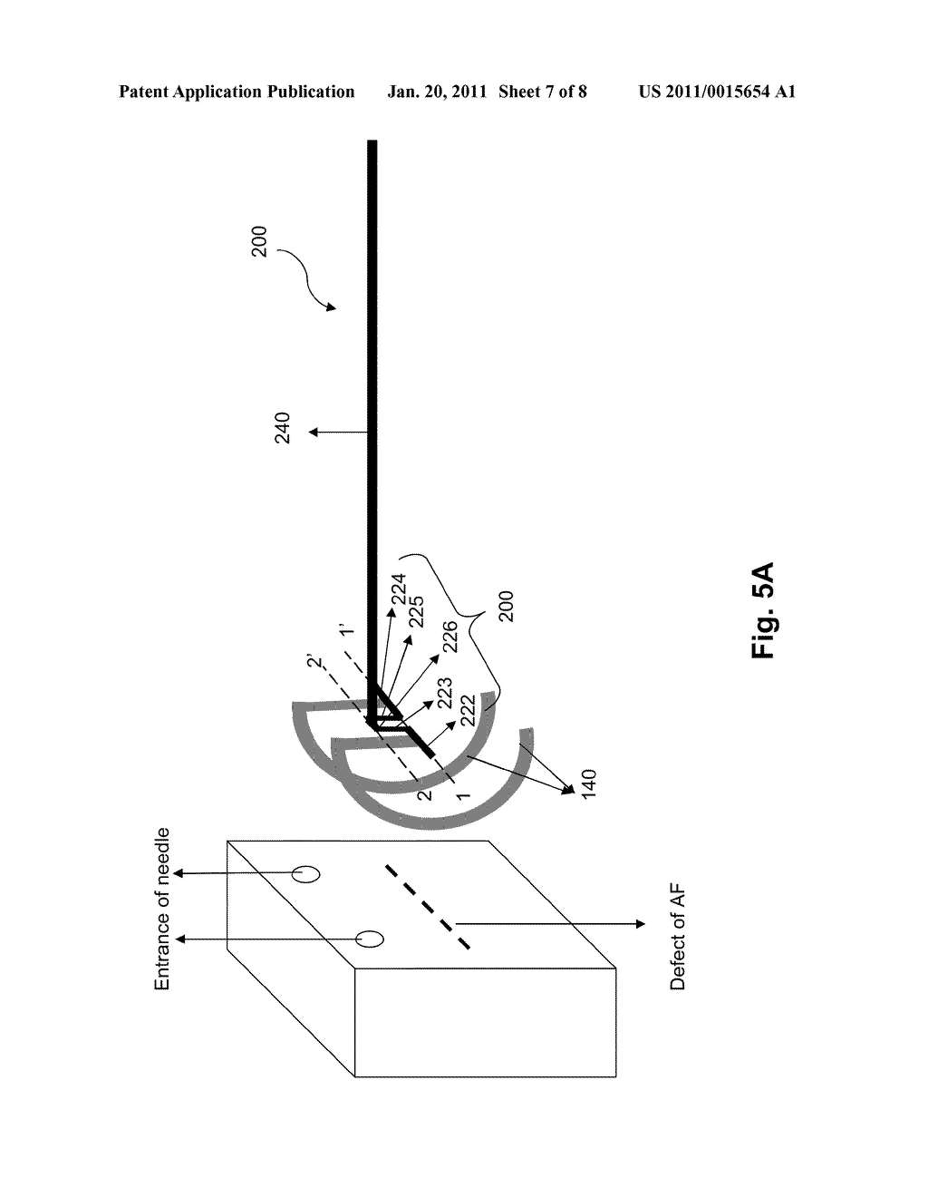 SPINAL DISC ANULUS REPAIR METHOD AND APPARATUS - diagram, schematic, and image 08