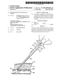 Percutaneous Puncture Sealing System diagram and image