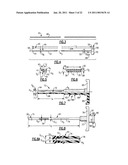 Percutaneous Puncture Sealing System diagram and image