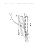 Percutaneous Puncture Sealing System diagram and image