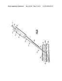 Percutaneous Puncture Sealing System diagram and image