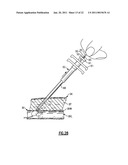 Percutaneous Puncture Sealing System diagram and image