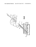 Percutaneous Puncture Sealing System diagram and image