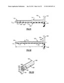 Percutaneous Puncture Sealing System diagram and image