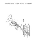 Percutaneous Puncture Sealing System diagram and image